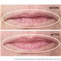 StriVectin Anti-Rides Double Fix For Lips Soin lèvres