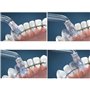 Embouts de demandeur de plaque de remplacement haute pression pour Waterpik WP-100 WP-250 WP-660, Accessoires pour buses, Pièces