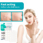 Pimple Patches 528 pièces, Hydrocolloïde Acné Patch, Invisible Naturel Patch Bouton, Utilisation de Jour et de Nuit, 2 en 1, Ave