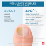 PODERM – HUILE SERUM ONGLES JAUNES – Améliore l’apparence de l’ongle – Agit dès le 1er Jour - Clarifie & Lisse l’Ongle – Ingrédi