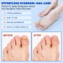 Patchs pour les Mycoses des Ongles (21 pièces), Traitement et Réparation des Mycoses des Ongles des Pieds, Multi-usages pour les