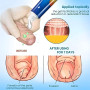 Henjunu Lot de 2 Gels Correcteurs de Phimosis pour Rétrécissement du Prépuce,Gel Correcteur pour L'excès de Prépuce,Ingrédients 