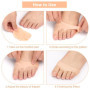 Lot de 4 Coussinets Métatarsiens Anti-Échauffement/Douleur, Coussinet Plantaire Gel Coussin, Coussinet D'avant-Pied, Coussinets 