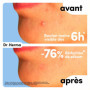 Dr. Herma - Patch Anti Bouton Invisible - Traitement Discret Rapide & Efficace de l’Acné 6 à 8h - Formule Médicale Acide Salicyl