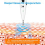 Rhorawill Stylo Acupuncture Stylo électronique D'acupuncture Sans Aiguille Soulagement de la Douleur Détecteur Point D'acupunctu
