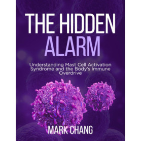 Le Système d'Alerte Caché : Comprendre le MCAS