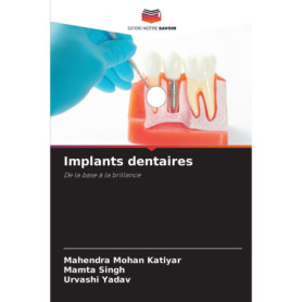 Guide Complet sur les Implants Dentaires