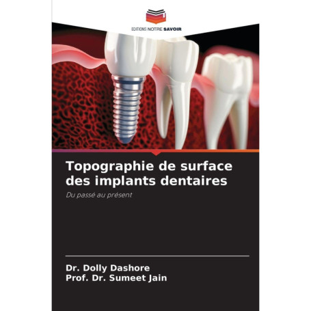 Topographie des Implants Dentaires : Innovations et Ostéointégration