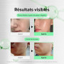 VT COSMETICS CICA Reedle Shot 300, Exosome de Nuit Avancé, Sérum de Microaiguilles, Centella Asiatica, Acide Hyaluronique, Propo