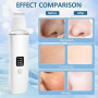 ACWOO Épurateur de Peau, Nettoyeur de Peau Ultrasonique avec 4 Modes, Ultrasonique Épurateur Visage, Skin Scrubber, Appareil de
