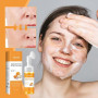 Turmeric Lot de 2 nettoyants pour le visage 100 ml, mousse nettoyante apaisante, curcuma et acide kojique, nettoyant pour le vis