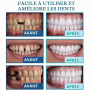 Prothèses Réglables à Clipser,Dentier Provisoire Prothese | Dentaires fonctionnelles,Prothèses à Facettes Réglables,Dentier Sour